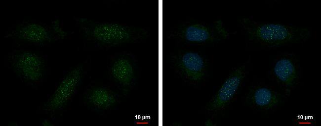 TRF1 antibody [4E4] detects TRF1 protein at telomere by immunofluorescent analysis.Sample: U2OS cells were fixed in 4% paraformaldehyde at RT for 15 min.Green: TRF1 protein stained by TRF1 antibody [4E4] (NBP1-41217) diluted at 1:500.Blue: Hoechst 33342 staining. 