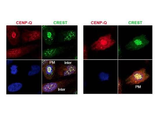 Immunofluorescence microscopy using protein A purified anti-CENP-Q antibody shows detection of endogenous CENP-Q in HeLa whole cell lysate. Primary antibody was used at 1:100 followed by secondary antibody diluted 1:150. Red punctate anti-CENP-Q signal colocalizes in overlay images with green punctate anti-CREST signals at the kinetochores (attached points of sister chromatids). Visible are colocalized CENP-Q and CREST signal at various stages of the cell cycle as indicated from interphase to the end of mitosis. Nuclei are counter stained with bisbenzimide. Personal Communication, Kyung S. Lee, CCR-NCI, Bethesda, MD