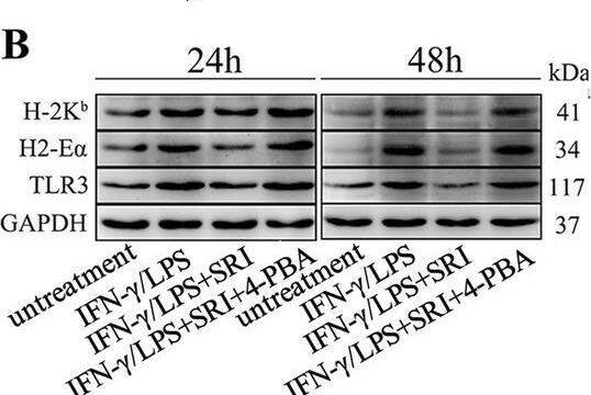 TGF-beta  signaling inhibits immunological characteristics of myofibers through activating the IRE1 alpha  pathway. Western blot analyses of the expression changes of Smad pathway proteins, IRE1 alpha  and PERK pathway proteins, and immunological molecules in MPC-myotubes isolated from SM TGF-beta r2−/− mice, with or without 48 h stimulation of IFN-gamma /LPS and/or SRI (A); 24 or 48 h stimulation of IFN-gamma /LPS, SRI, 4-PBA, 4μ8C (IRE1 alpha  pathway inhibitor) or GSK (PERK pathway inhibitor) (B, D). The relative protein expression values are expressed as a ratio [protein of interest/GAPDH or phosphorylated (P) protein/total (T) protein]. C mRNA levels of IL-1 beta , IL-6, and MCP-1 in MPC-myotubes isolated from SM TGF-beta r2−/− mice, with or without 48 h stimulation of IFN-gamma /LPS, SRI and/or 4-PBA,analyzed by qPCR. All data are presented as means +/- SD (n = 3). A one-way ANOVA was used for multiple comparisons (*P < 0.05; **P < 0.01) Image collected and cropped by CiteAb from the following open publication (//pubmed.ncbi.nlm.nih.gov/36849929), licensed under a CC-BY license. Not internally tested by Novus Biologicals.
