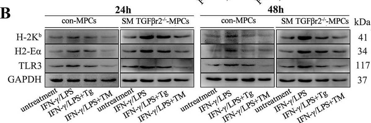 Intrinsic TGF-beta  signaling affects muscle cell immune behaviors by prompting UPR activity under pro-inflammatory conditions. The protein levels of IRE1 alpha  and eIF2 alpha  (A), H-2Kb, H2-E alpha , and TLR3 (B) in control or SM TGF-beta r2−/− mice-derived MPC-myotubes, with or without stimulation of IFN-gamma /LPS, Tg, or TM, were analyzed by Western blot. The relative protein expression values are expressed as a ratio [protein of interest/GAPDH or phosphorylated (P) protein/total (T) protein]. C mRNA levels of IL-1 beta , IL-6, and MCP-1 in MPC-myotubes with or without 48 h stimulation of IFN-gamma /LPS, Tg, or TM, analyzed by qPCR. All data are presented as means +/- SD (n = 3). A one-way ANOVA was used for multiple comparisons (*P < 0.05; **P < 0.01) Image collected and cropped by CiteAb from the following open publication (//pubmed.ncbi.nlm.nih.gov/36849929), licensed under a CC-BY license. Not internally tested by Novus Biologicals.