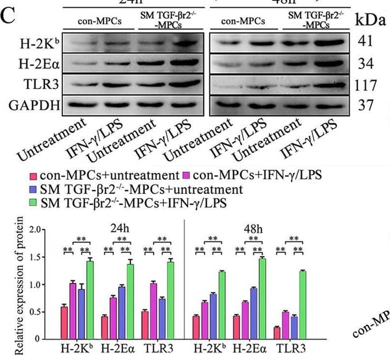 Intrinsic TGF-beta  signal controls immunological molecules and myokine expression in cultured primary myotubes. A Representative immunofluorescence staining for desmin, myogenin, eMHC, and TGF-beta r2 in SM TGF-beta r2−/− mice-derived MPC-myotubes (MPCs) that received pro-inflammatory stimuli or not. B, C Western blot analysis of the protein expression of p-Smad2/3, H-2Kb, H2-E alpha , and TLR3 in MPC-myotubes that received pro-inflammatory stimuli or not. D Luminex assay of protein level changes for pro-inflammatory myokines in control or SM TGF-beta r2−/− mice-derived MPC-myotubes exposed to inflammatory milieu or not. Before creating the heat map, log transformation was used to process the data and plot in R language. The relative protein levels are expressed as a ratio (protein of interest/GAPDH). All data are presented as means +/- SD (n = 3 replicates). One-way ANOVA was used for multiple comparisons (**P < 0.01; ***P < 0.001). Bar = 50 μm Image collected and cropped by CiteAb from the following open publication (//pubmed.ncbi.nlm.nih.gov/36849929), licensed under a CC-BY license. Not internally tested by Novus Biologicals.