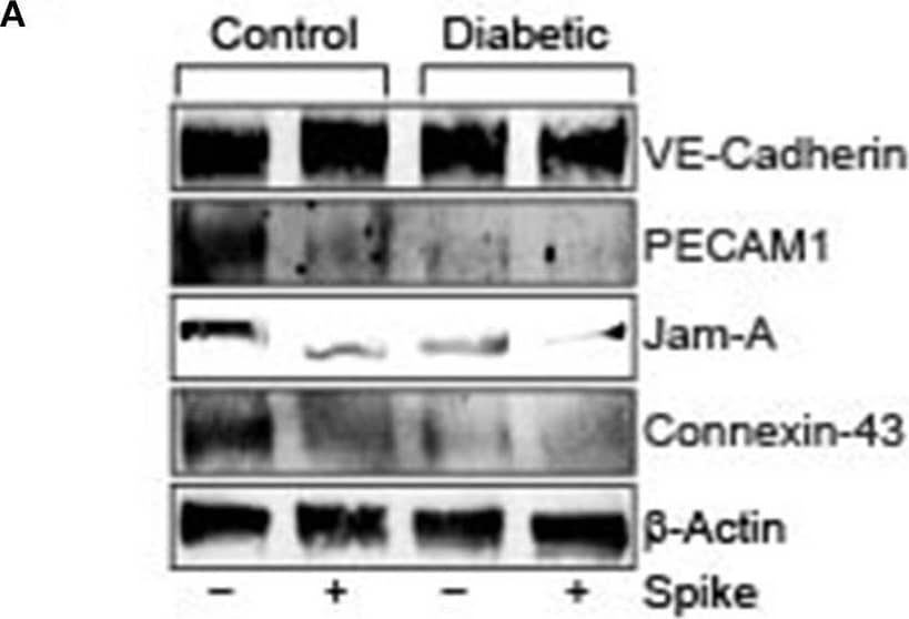 Spike-induced degradation of endothelial junctional proteins is greater in arteries of diabetic mice. (A) Representative Western blot indicating expression of endothelial junctional proteins in arteries isolated from control or diabetic mice. (B) Mean data indicating fold change in protein expression. n = 4 for each, *P < 0.05 vs. untreated control, δP < 0.05 vs. untreated diabetic, #P < 0.05 vs. Spike-treated control. Image collected and cropped by CiteAb from the following open publication (//pubmed.ncbi.nlm.nih.gov/34179146), licensed under a CC-BY license. Not internally tested by Novus Biologicals.