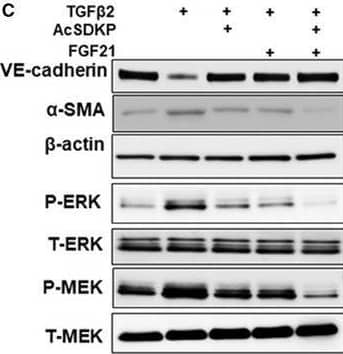 Either FGF19 or FGF21 enhanced the inhibitory effect of AcSDKP on EndMT and MEK/ERK pathway. In the presence of AcSDKP, HMVECs were stimulated by TGF beta 2 with or without FGF19 (100 ng·mL−1) or FGF21 (100 ng·mL−1) treatment. The levels of VE‐cadherin/ beta ‐Actin,  alpha ‐SMA/ beta ‐Actin, P‐ERK/T‐ERK, and P‐MEK/T‐MEK were examined by western blot analysis (A, C) and quantified (B, D). The data represent mean +/- SD. Three independent experiments were performed for each result. ANOVA with Tukey's multiple comparisons test was applied. Image collected and cropped by CiteAb from the following open publication (//pubmed.ncbi.nlm.nih.gov/30972974), licensed under a CC-BY license. Not internally tested by Novus Biologicals.