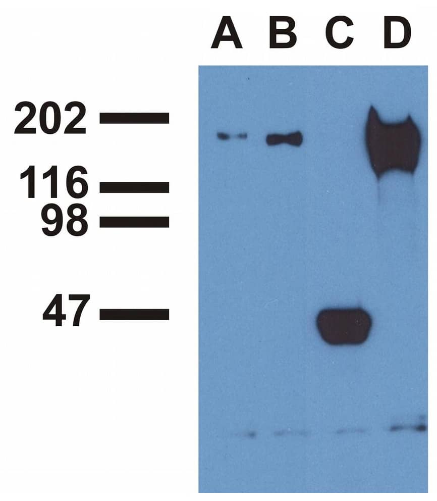 Separation of EGF stimulated A431 cell suspension stained using anti-human EGFR (pY1173) (EM-13) purified antibody (concentration in sample 3 ug/ml, GAM PE, red-filled) from EGF stimulated A431 cell suspension unstained by primary antibody (GAM PE, black-dashed) in Analysis (intracellular staining).