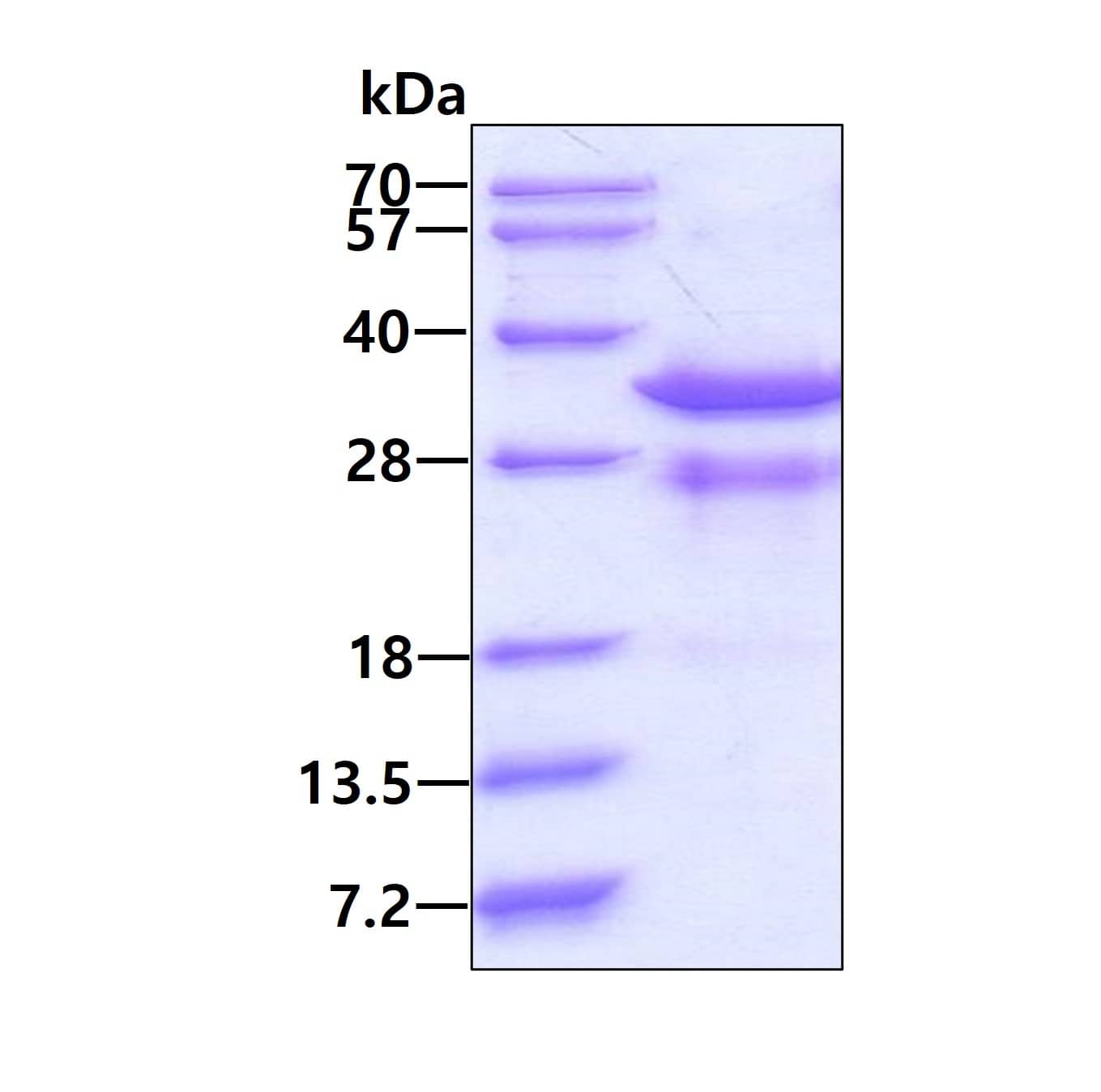 SDS-PAGE Recombinant Human Rad1 His Protein