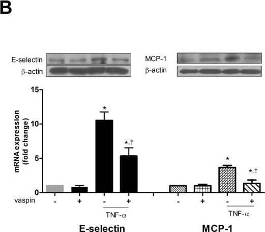 Vaspin inhibits TNFalpha-induced expression of adhesion molecules. The effect of vaspin on TNFalpha-induced expression of ICAM-1 (A), VCAM-1 (A), E-selectin (B), and MCP-1 (B). The protein level and mRNA expression of each adhesion molecule was measured at 24 hr after treatment with 100 ng/mL vaspin in the presence or absence of 10 ng/mL TNFalpha. Data shown are representative Western blots (top panels) and mean values +/- SEM of three independent experiments (bottom panels). The fold change in mRNA expression compared to levels in untreated cells is shown. *p < 0.05 vs. untreated cells, and +p < 0.05 vs. cells treated with TNFalpha alone. Image collected and cropped by CiteAb from the following publication (//pubmed.ncbi.nlm.nih.gov/24517399), licensed under a CC-BY licence.