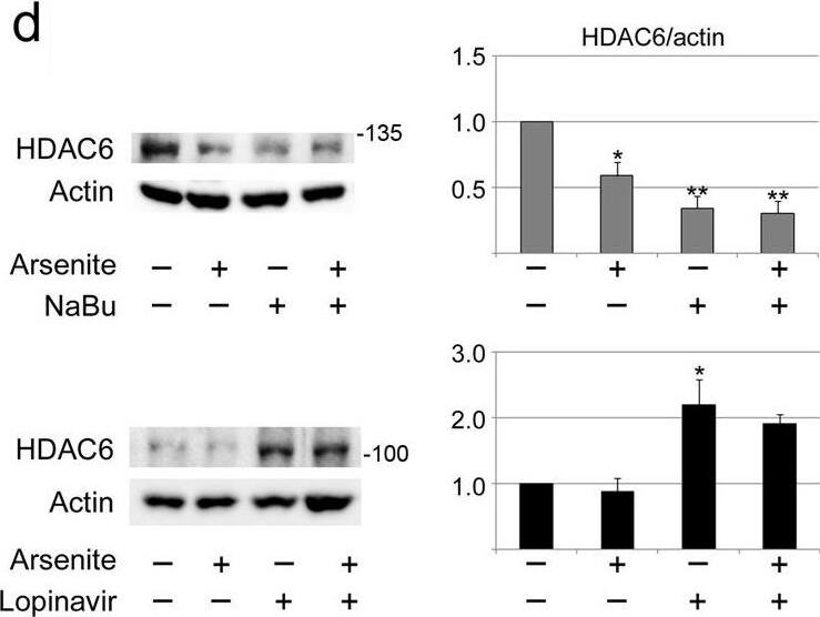 Senescent intestinal cells reorganize microtubules.a Microtubule stability was evaluated with nocodazole for IECs treated with vehicle (V), sodium butyrate (NaBu), or lopinavir. Disassembly or partial disassembly was scored10. Data were normalized to vehicle controls. Average + SEM are shown for three independent experiments. For each experiment, 100–157 cells were examined for every time point and condition. b Immunocytochemistry revealed changes in the abundance and organization of  alpha -tubulin acetylated on K40 and total  alpha -tubulin (Tubulin). DAPI stained nuclei; scale bar is 20 um. Graphs depict pixel intensities/cells normalized to vehicle controls (V). At least 135 cells were assessed for each condition. Bars represent average + SEM. c Semiquantitative Western blotting determined the abundance of  alpha -tubulin acetylated on K40 (Ac-K40-Tubulin) and total  alpha -tubulin. Actin was used as a loading control. Between three and seven independent experiments were evaluated by Western blotting. d Western blotting determined the abundance of HDAC6, Rock1, and Rock2 for the conditions depicted. Graphs represent averages + SEM for 3–8 independent experiments. a, b Student’s t-test evaluated differences between control and senescent cells; *p < 0.05; **p < 0.01; ***p < 0.001. c, d The molecular masses of marker proteins in kDa are indicated at the right margin of blots. One-way ANOVA combined with Bonferroni correction identified significant differences between the vehicle control and treated cells. *p < 0.05; **p < 0.01; ***p < 0.001. Image collected and cropped by CiteAb from the following open publication (//pubmed.ncbi.nlm.nih.gov/36526654), licensed under a CC-BY license. Not internally tested by Novus Biologicals.