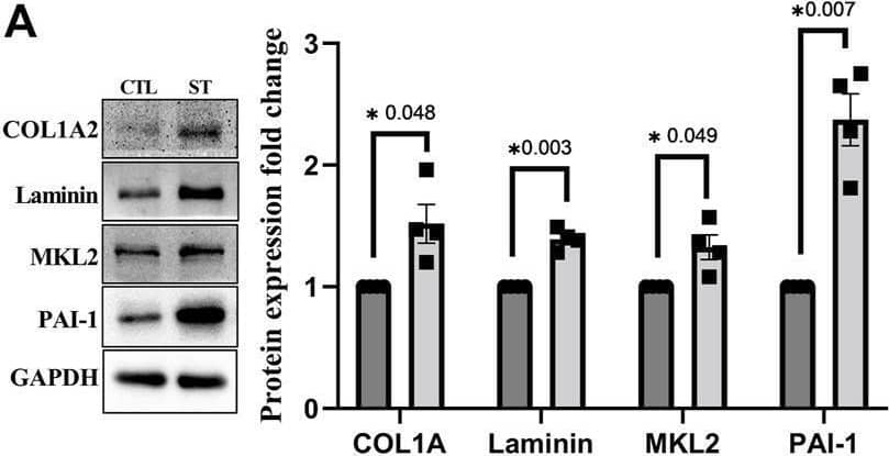 Immunoblot analysis for ECM and fibrosis-related proteins and proteins involved in cholesterol biosynthesis. (A) Confirmatory analysis for protein expression changes in HTM cells subjected to CMS for 24 h. COL1A2, total laminin, MKL2, and PAI-1 showed a significant upregulation at 24 h of CMS (ST) compared to unstretched control (CTL). (B) Confirmatory analysis for proteins involved in cholesterol biosynthesis in HTM cells subjected to CMS for 24 h. HMGCS1 and n-SREBP2 showed a significant upregulation at 24 h of CMS (ST) compared to unstretched control (CTL). The results were based on immunoblot analysis with subsequent densitometric analysis. GAPDH was immunoblotted as the loading control. Circles and boxes in the histograms represent sample numbers for CTL and ST, respectively. Values represent mean +/- SEM, where n = 4 (biological replicates). *p ≤ 0.050 was considered significant. Image collected and cropped by CiteAb from the following open publication (//pubmed.ncbi.nlm.nih.gov/36176278), licensed under a CC-BY license. Not internally tested by Novus Biologicals.