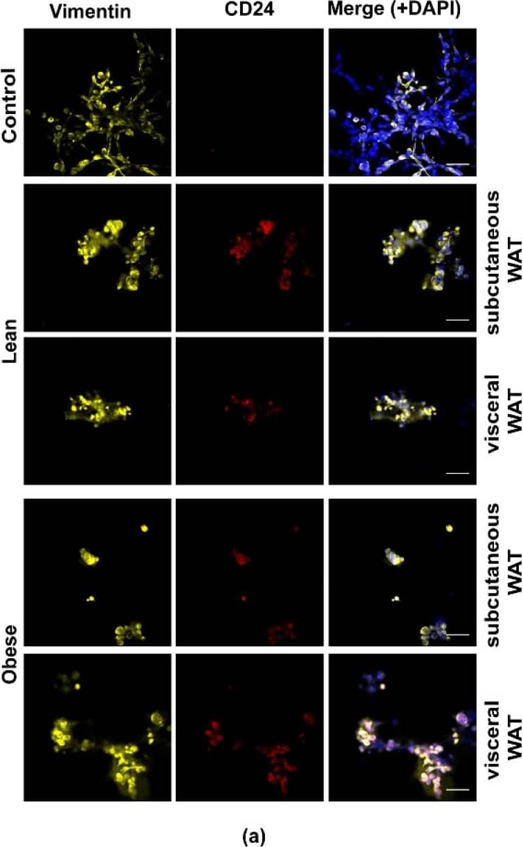 Mouse WAT-CM induces the expression of CD24 in mesenchymal MDA-MB-231 cells but does not affect the expression of vimentin. Representative images of MDA-MB-231 cells cultured with or without lean or obese subcutaneous or visceral WAT-CM and co-stained for vimentin, CD24, and DAPI (a); scale bar = 100 uM. (b) and (c) are the relative expression of the respective markers, mean +/- SEM (n = 6 biological replicates). The average protein expression from five images per replicate were normalized to DAPI and analyzed relative to the control cultures. Significance was determined by Friedman’s test. If significant, Dunn’s test was used for further pairwise comparison; * p < 0.05. Image collected and cropped by CiteAb from the following open publication (//pubmed.ncbi.nlm.nih.gov/32899433), licensed under a CC-BY license. Not internally tested by Novus Biologicals.
