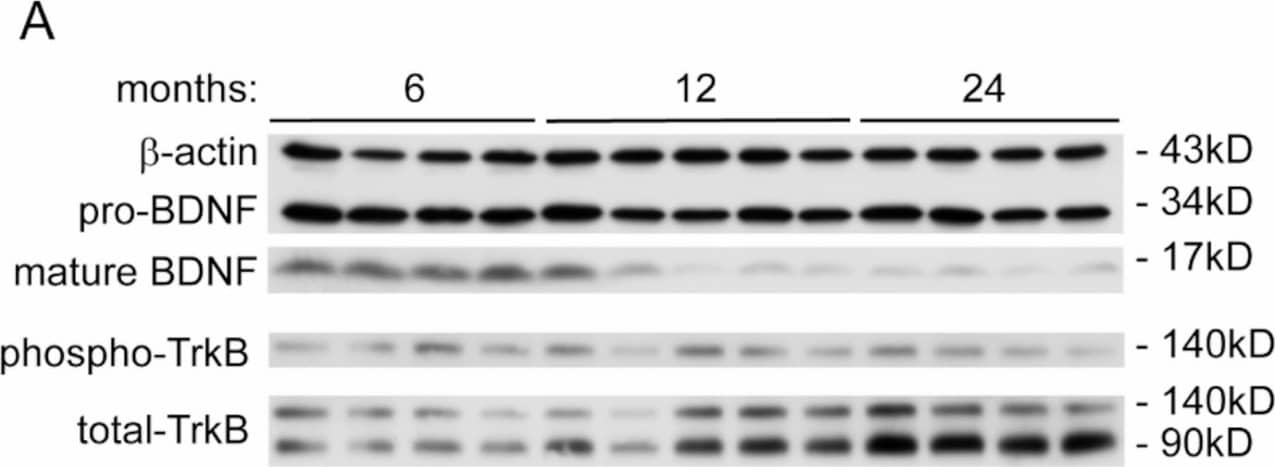 Aging reduces BDNF maturation in the brain. Brains of C57BL/6J mice at 6, 12 and 24 months of age were homogenized for quantitative Western blot of BDNF (A). Normal aging significantly reduced the protein levels of maturated BDNF, but not pro-BDNF (B and C; One-way ANOVA followed by Bonferroni post-hoc test; n = 5–11 per group). Aging did not decrease phosphorylated TrkB (D; One-way ANOVA; n = 4–5 per group), but significantly increased the protein level of total TrkB (E; One-way ANOVA followed by Bonferroni post-hoc test; n = 4–5 per group) Image collected and cropped by CiteAb from the following open publication (//actaneurocomms.biomedcentral.com/articles/10.1186/s40478-025-02181-y), licensed under a CC-BY license. Not internally tested by Novus Biologicals.