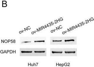 Western Blot NOP58 Antibody