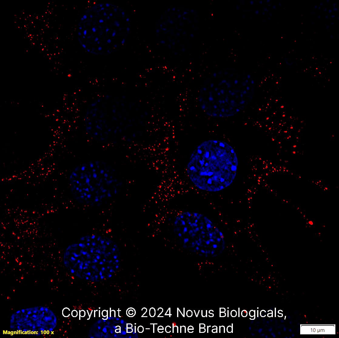 CD44 (8E2F3) was detected in immersion fixed NIH3T3 Mouse fibroblast cell line using Mouse anti- CD44 (8E2F3) Protein-G purified Monoclonal Antibody conjugated to DyLight 550 (Catalog # NBP1-47386R) (red) at 2 µg/mL overnight at 4C. Cells were counterstained with DAPI (blue). Cells were imaged using a 100X objective and digitally deconvolved.