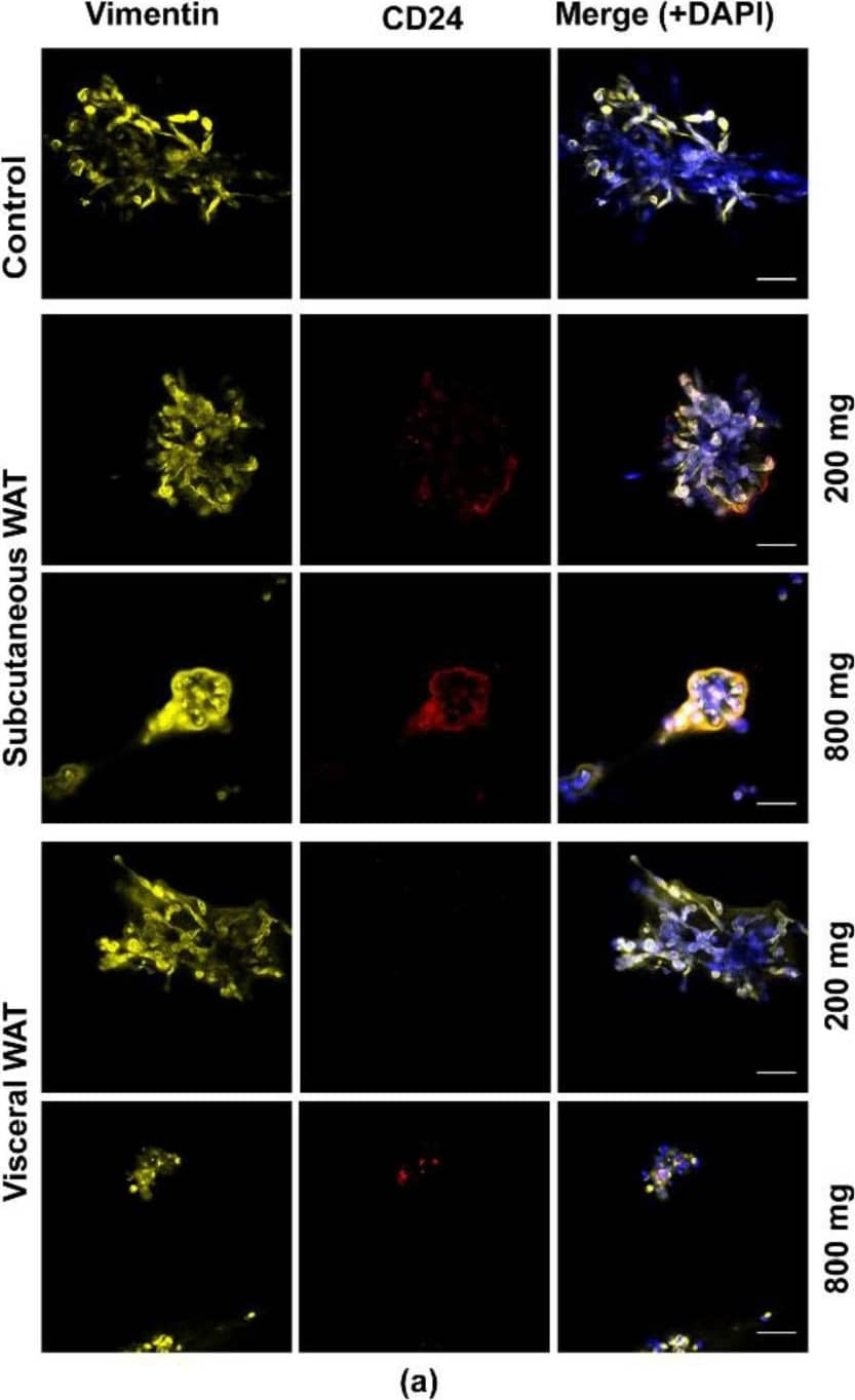 Effect of varied WAT masses from obese mice on vimentin and CD24 protein expression in MDA-MB-231 cells. (a) Representative images of MDA-MB-231 cells cultured with or without 200 mg or 800 mg of obese subcutaneous or visceral WAT-CM and co-stained with anti-vimentin, anti-CD24, and DAPI; scale bar = 100 um. (b) and (c) are the relative expression of the respective markers, mean +/- SEM (n = 6 biological replicates). The average protein expression from five images per replicate were normalized to DAPI and analyzed relative to the control cultures. No groups were found to be significantly different by the Friedman test. Image collected and cropped by CiteAb from the following open publication (//pubmed.ncbi.nlm.nih.gov/32899433), licensed under a CC-BY license. Not internally tested by Novus Biologicals.