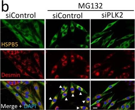 Relationship between phosphorylation and subcellular localization of HSPB5. (a) Localization of overexpressed recombinant HSPB5 and endogenous PLK2. After 5 uM MG132 treatment (24 h), FLAG-tagged HSPB5 and endogenous PLK2 in undifferentiated L6 cells were immunofluorescently stained with anti-tag and anti-PLK2 antibodies. (b) Effect of PLK2 on localization of HSPB5 and desmin protein. Endogenous HSPB5 and desmin were immunofluorescently stained with anti-HSPB5 and anti-desmin antibodies. Undifferentiated L6 cells were transfected with siRNA to knockdown PLK2. After differentiation (48 h), L6 myotubes were treated with MG132 for 24 h. White arrowheads indicate cells with colocalization of HSPB5 and desmin at perinuclear ER region. Scale bar indicates 20 μm. Image collected and cropped by CiteAb from the following open publication (//pubmed.ncbi.nlm.nih.gov/36232565), licensed under a CC-BY license. Not internally tested by Novus Biologicals.