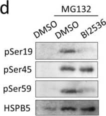 PLK2 phosphorylates HSPB5 at serine 19 under ER stress. (a) Knockdown efficiency of PLK2 by siRNA. L6 cells were transfected with siRNA to knockdown PLK2 and treated with 5 uM MG132 for 24 h. Graph presents relative value of expression level of PLK2. Data in graphs represent means +/- standard error (n = 3). Statistical analyses were performed using t-test. ** p < 0.01. (b) Schematic representation of three known phosphorylation sites of HSPB5. Arrows indicate name of the kinase catalyzing phosphorylation. (c) Effect of PLK2 on each phosphorylation site. Undifferentiated L6 cells were transfected with siRNA to knockdown PLK2. After differentiation (48 h), L6 myotubes were treated with 5 uM MG132 for 24 h. Phosphorylation level was detected by Western blotting with specific antibodies. Graph presents ratio of phosphorylated HSPB5/HSPB5 after quantification of each band. Data in graphs represent means +/- standard error (n = 3). Statistical analyses were performed using one-way ANOVA with Tukey test. ‡ p < 0.01, † p < 0.05; n.s. not significant. (d) Effect of PLK2 activity on phosphorylation of serine 19. After differentiation (48 h), L6 myotubes were treated with 10 nM BI2536 and 5 uM MG132 for 24 h. Phosphorylation level was detected by Western blotting with specific antibodies. Image collected and cropped by CiteAb from the following open publication (//pubmed.ncbi.nlm.nih.gov/36232565), licensed under a CC-BY license. Not internally tested by Novus Biologicals.