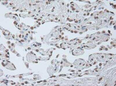 Immunohistochemistry-Paraffin: IL-6 Antibody (OTI3G9) [NBP1-47810] - Staining of Human lung tissue within the normal limits using anti-IL-6 mouse monoclonal antibody. (Heat-induced epitope retrieval by 10mM citric buffer, pH6.0, 100 degrees C for 10min.)