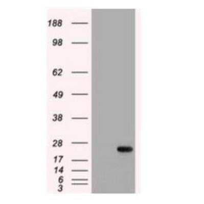 Western Blot: IL-6 Antibody (OTI3G9) [NBP1-47810] - HEK293T cells were transfected with the pCMV6-ENTRY control (Left lane) or pCMV6-ENTRY IL-6 ( Right lane) cDNA for 48 hrs and lysed. Equivalent amounts of cell lysates (5 ug per lane) were separated by SDS-PAGE and immunoblotted with anti-IL-6.