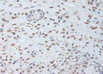 Immunohistochemistry-Paraffin: IL-6 Antibody (OTI3G9) [NBP1-47810] - Staining of Human Ovary tissue within the normal limits using anti-IL-6 mouse monoclonal antibody. (Heat-induced epitope retrieval by 10mM citric buffer, pH6.0, 100 degrees C for 10min.)