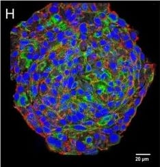 Immunohistochemical characterization of tissue, 2D-, and 3D-cultures. Nuclei are labeled with DAPI (blue) in all images. (A) Cryosection of an adult mouse heart immunostained for myomesin (red) and vimentin (green). (B) Confocal optical section on the substrate level of a spheroid made of hiPSC-CM and CF cultured for 1 month. Immunostaining for myosin heavy chain (red), and vimentin (green). (C) Confocal optical section above the substrate level of the same spheroid as shown in (B). (D) 2D-cultured cardiac fibroblasts immunostained for alpha-SMA (red) and all actin (green) shown as a maximum intensity projection of optical sections. (E) Single confocal optical sections perpendicular to the substrate through a CF-only, small spheroid (above) cultured for 5 days and immunostained for all actin (red) and alpha-SMA (green), and an optical section at midlevel (below). (F) Cryosection of fibroblast-only spheroid cultured for 3 weeks immunostained for vimentin (red) and alpha-SMA (green). (G) Western blot experiments and quantitative assessment of the ratio of alpha-SMA/vimentin (n = 4, ***p < 0.001) demonstrating the difference of alpha-SMA content in 2D vs. 3D cultures of pure CF. (H) Whole-mount immunostaining of a cardiomyocyte-only spheroid 1 month in culture, N-cadherin (red) and EH-myomesin (green). (I) Cardiomyocyte-only spheroid 1 month in culture, whole-mount immunostained for all-actin (red) and laminin (green). Image collected and cropped by CiteAb from the following open publication (//pubmed.ncbi.nlm.nih.gov/32118040), licensed under a CC-BY license. Not internally tested by Novus Biologicals.