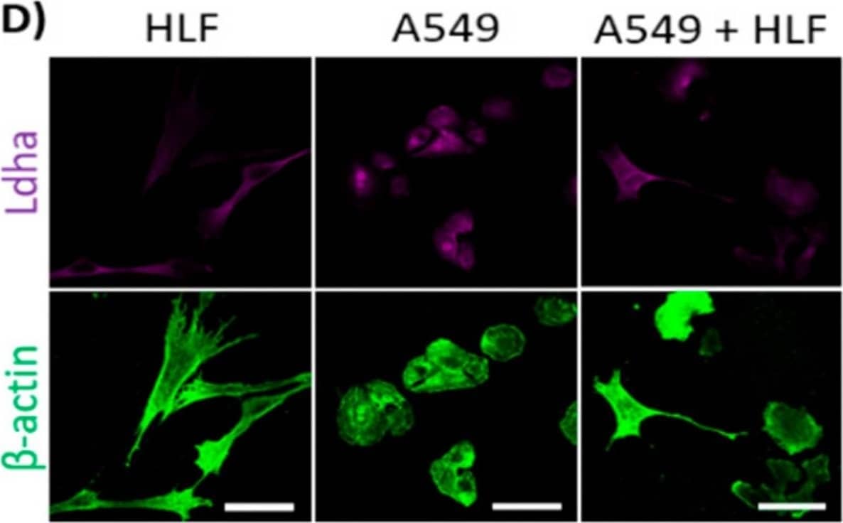 The effect of the co-culturing of cancer cells and fibroblasts on the expression of Hk2 and Ldha. (A) and (B): the co-culturing of fibroblasts (murine lung fibroblasts (MLF) or human lung fibroblasts (HLF)) with respective cancer cells (KLN205 or A549) decreased the level of Hk2 in cancer cells, having only a minor effect on the enzyme in fibroblasts. (C) and (D): in the co-cultures, the expression of Ldha was reduced in cancer cells, but was elevated in fibroblasts. Bar = 50 um. The black and white images depict differences in the shape and size of fibroblasts and cancer cells in the co-cultures. The ratio of the fluorescence of Hk2 and Ldha to  beta -actin in the MLF and HLF monocultures was assumed to be 1. Asterisks indicate a statistically significant difference (p < 0.05). All the experiments were performed in triplicate and obtained similar results, and representative data from one experiment are shown in the figure. Image collected and cropped by CiteAb from the following open publication (//pubmed.ncbi.nlm.nih.gov/31947613), licensed under a CC-BY license. Not internally tested by Novus Biologicals.