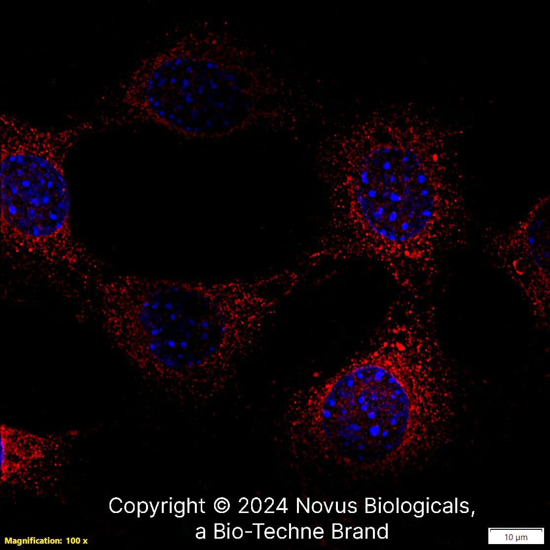 CCR2 was detected in immersion fixed NIH3T3 Mouse fibroblast cell line using Rabbit anti-CCR2 Antigen Affinity-purified Polyclonal Antibody conjugated to DyLight 550 (Catalog # NBP1-48338R) (red) at 10 µg/mL overnight at 4C.  Cells were counterstained with DAPI (blue). Cells were imaged using a 100X objective and digitally deconvolved.