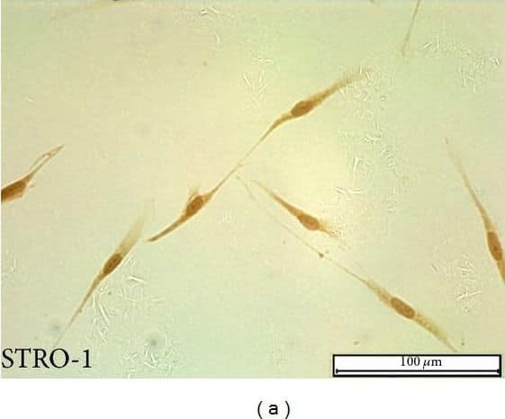 Characterization of SCAPs: (a) isolated SCAPs were positive for STRO-1 by immunocytochemistry; (b) isolated SCAPs were negative for CK by immunocytochemistry; (c) PBS served as a negative control; (d) flow cytometric analysis revealed that cultured SCAPs are positive for CD73 (99.99%), CD105 (99.99%), CD90 (99.94%), and CD146 (91.84%), but negative for CD34 (0.84%) and CD45 (2.97%). Mouse IgG isotype control antibodies conjugated to FITC, PE, APC, or PerCP were used as negative controls. Scale bars: 100 μm. Image collected and cropped by CiteAb from the following open publication (//pubmed.ncbi.nlm.nih.gov/24864235), licensed under a CC-BY license. Not internally tested by Novus Biologicals.