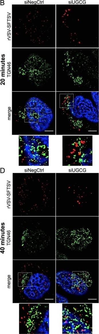 Immunofluorescence microscopy of rVSV-SFTSV particles following UGCG knockdown.(A-D) U-2 OS cells were transfected with siRNAs targeting UGCG (siUGCG) or a non-targeting control (siNegCtrl) and plated onto glass coverslips. At 72 hours post-transfection cells were chilled to 4C on ice and rVSV-SFTSV was bound by centrifugation (1200xg, 30’, 4C). Following centrifugation, media was replaced with pre-warmed media (37C) and the cells placed in a 37C incubator for 20 or 40 minutes before fixation in 1% paraformaldehyde for 15 minutes. Cells were then immunostained for viral antigen (anti-VSV M, red), cellular markers (green), and nuclei stained with DAPI (blue). Images are representative from at least 3 independent experiments. (A,B) U-2 OS cells fixed after 20 minutes were co-stained for rVSV-SFTSV (red) and EEA1 (A) or TGN46 (B) (green). (C,D) U-2 OS cells fixed after 40 minutes and stained as above. Boxes indicate zoomed-in regions. Scale bar represents 5μm. Image collected and cropped by CiteAb from the following open publication (//pubmed.ncbi.nlm.nih.gov/28388693), licensed under a CC-BY license. Not internally tested by Novus Biologicals.