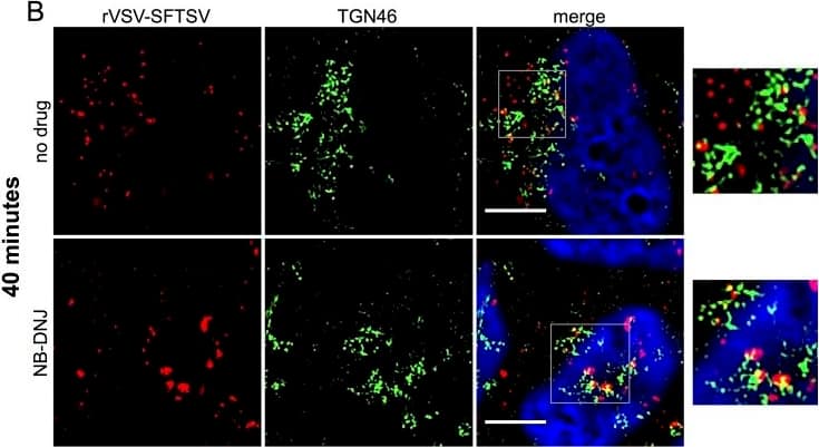 Immunofluorescence microscopy and quantification of incoming virus particles.(A, B) A549 cells prepared as described in Fig 8 were fixed 40 minutes post-warming and co-stained for rVSV-SFTSV (red) and the early endosome marker EEA1 (green) (A) or TGN46 (B). Cells were treated with NB-DNJ (bottom panels) or left untreated (top panels). Boxes indicate zoomed-in regions. Scale bar represents 5μm. (C, D) Quantitative image analysis was performed to measure the volume of discrete VSV M-stained puncta within z-stack images in untreated and NB-DNJ treated cells at both 20 and 40 minutes post-warming. Puncta were counted for at least 6 independent z-stacks per sample for both rVSV-SFTSV (C) and VSV (D) infected cells. (**** p<0.0001 using Welch’s one-tailed t-test). Image collected and cropped by CiteAb from the following open publication (//pubmed.ncbi.nlm.nih.gov/28388693), licensed under a CC-BY license. Not internally tested by Novus Biologicals.