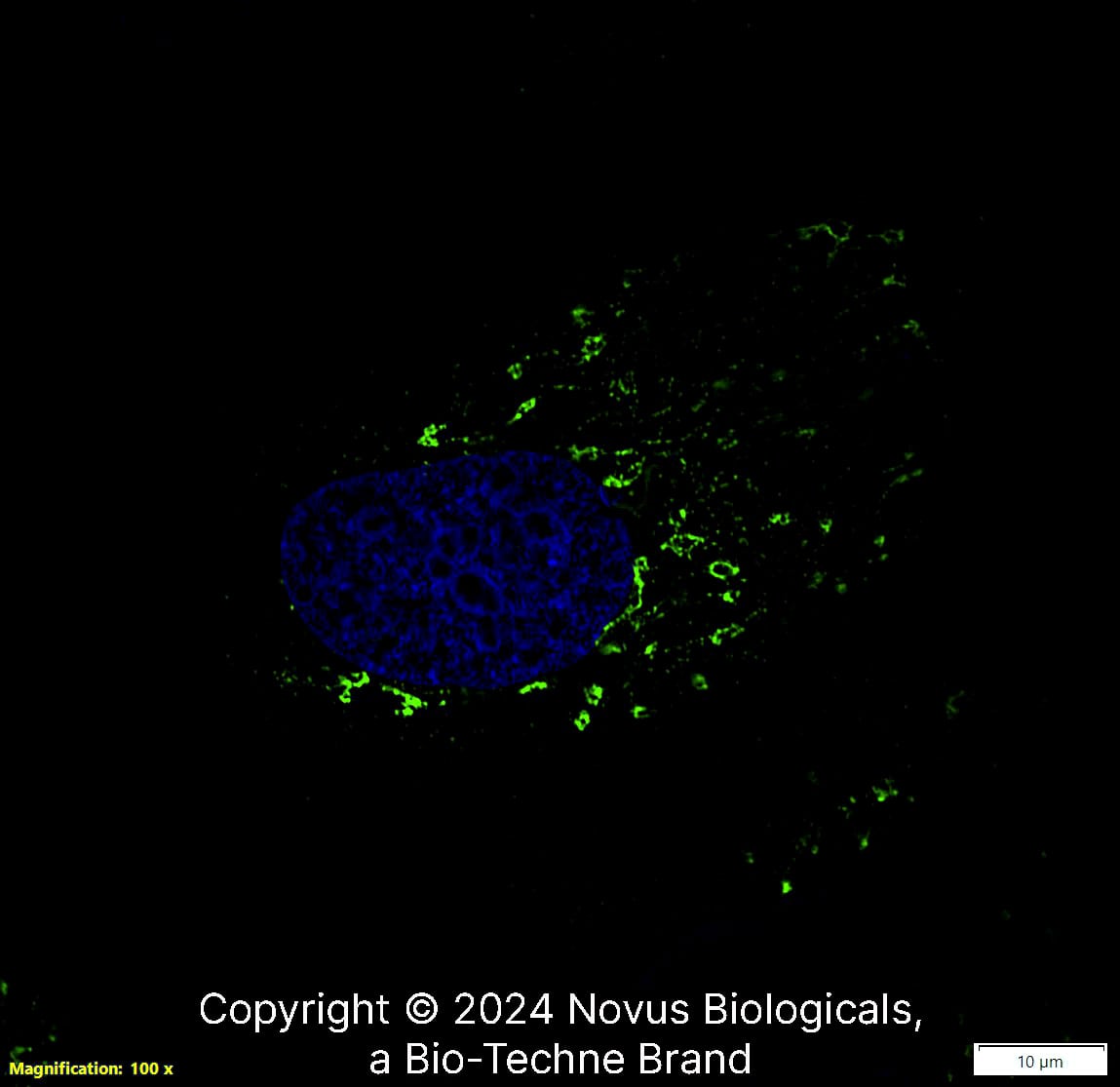 TGN46 was detected in immersion fixed Caco-2 human colorectal adenocarcinoma cell line using Rabbit anti-TGN46 Affinity Purified Polyclonal Antibody conjugated to Alexa Fluor® 488 (Catalog # NBP1-49643AF488) (green) at 2 µg/mL overnight at 4C. Cells were counterstained with DAPI (blue). Cells were imaged using a 100X objective and digitally deconvolved.