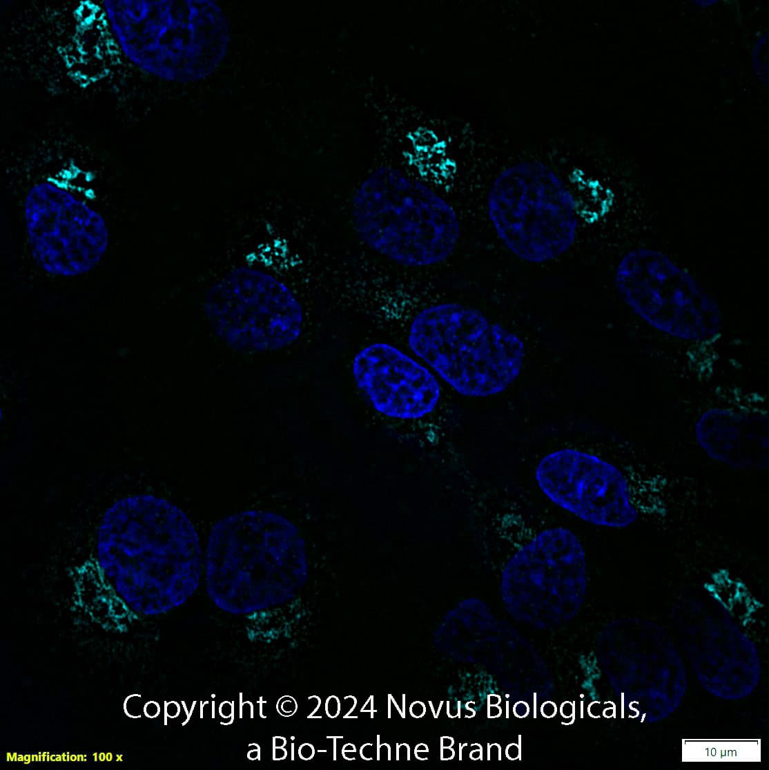 TGN46 was detected in immersion fixed HepG2 human hepatocellular carcinoma cell line using Rabbit anti-TGN46 Affinity Purified Polyclonal Antibody conjugated to Alexa Fluor® 647 (Catalog # NBP1-49643AF647) (light blue) at 2 µg/mL overnight at 4C. Cells were counterstained with DAPI (dark blue). Cells were imaged using a 100X objective and digitally deconvolved.