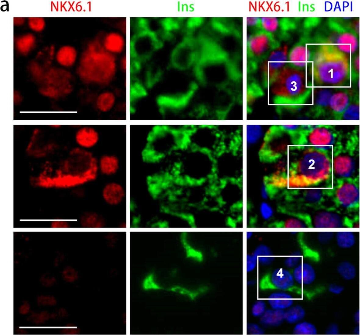 Immunocytochemistry/ Immunofluorescence NKX6.1 Antibody - BSA Free