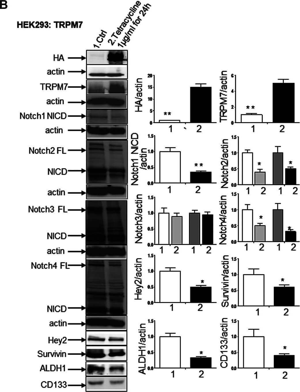 TRPM7 is expressed in GBM and positively correlates with the activation of Notch1, and the upregulation of TRPM7 activates Notch1 signaling. (A) The U87MG cells were transfected with (A) wild-type human TRPM7 (M7-wt); (B) two  alpha -kinase-inactive mutants, “ alpha -kinase-dead