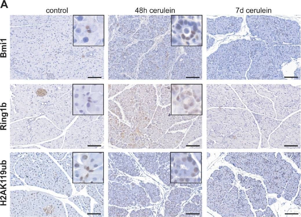 Immunohistochemistry: RNF2 Antibody [NBP1-49966] - Epigenetic remodelers were overexpressed in pancreatitis & pancreatic cancer(A) Immunohistochemistry staining of Bmi1, Ring1b & H2AK119ub in eight week old control mice, 48 hours & seven days after the last cerulein injection (n = 5). Representative images include boxes with high magnification to demonstrate nuclear staining of centroacinar (control) & ADM (48h) cells. Bar, 100 μm. (B) Positive stained nuclei of Bmi1, Ring1b & H2AK119ub per high power field (HPF) were counted & quantified. Data are presented as mean ± SEM from three pictures of each animal. (C) Immunohistochemistry staining against Bmi1, Ring1b & H2AK119ub of pancreatic tissue from three week old KPC mice representing morphological normal tissue, from ten week old mice showing preinvasive ductal lesions & from 20 week old KPC mice demonstrating full PDAC (n = 5). High magnification images represent nuclear staining of centroacinar cells (3w-normal) or ADMs (10w-ADM). Bar, 100 μm. (D) Positive stained nuclei of Bmi1, Ring1b & H2AK119ub per high power field (HPF) were counted & quantified. Data are presented as mean ± SEM from three pictures of each animal. Image collected & cropped by CiteAb from the following publication (//pubmed.ncbi.nlm.nih.gov/26716510), licensed under a CC-BY license. Not internally tested by Novus Biologicals.