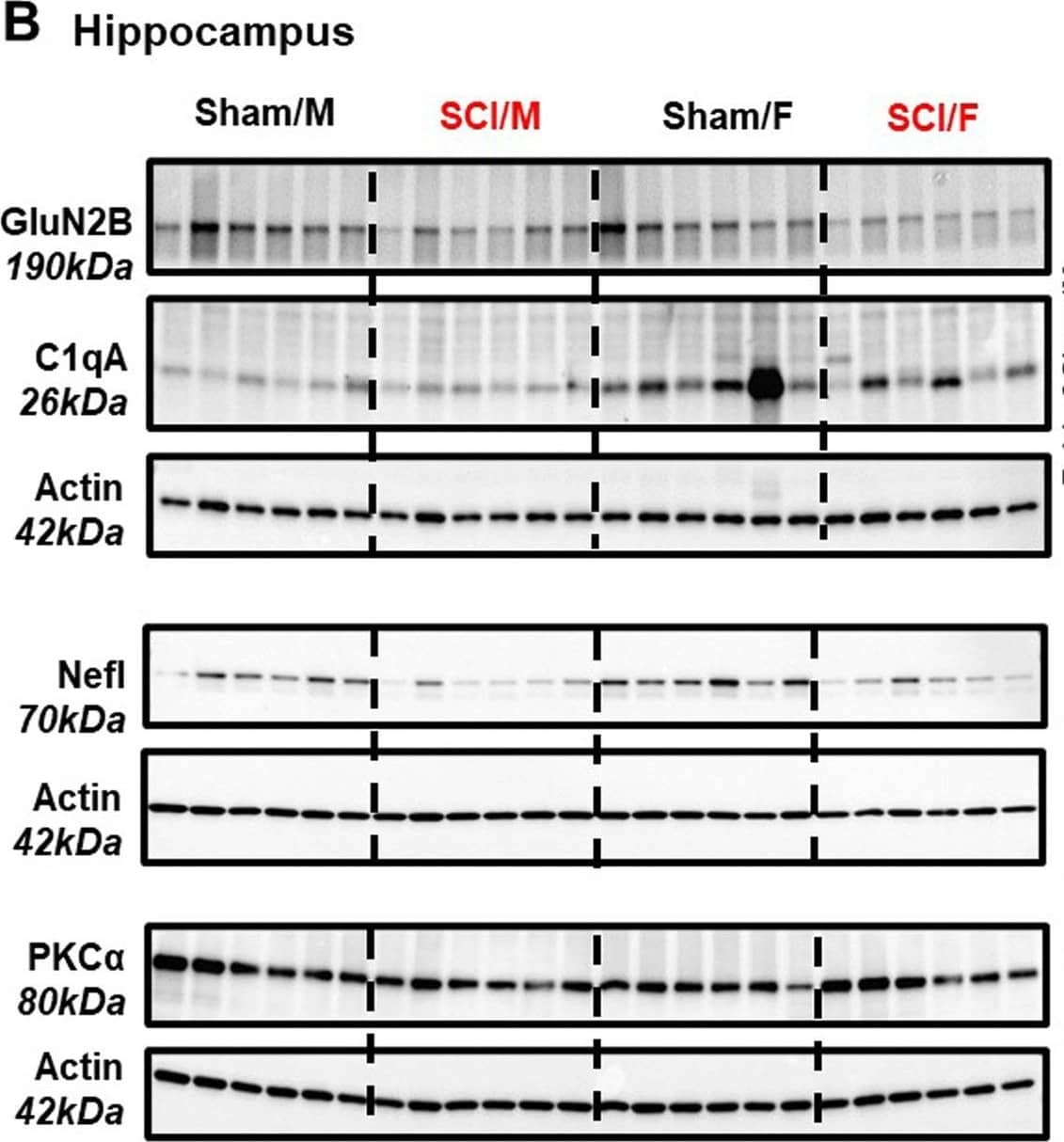 Validation of Nanostring DEGs with Western blot. Tissue samples from the cortex (A) and hippocampus (B) were processed for Western blot analysis to validate the top DEGs derived from Nanostring. A Expression of the DEG markers PSD95 (Dlg4), NCX1 (Slc8a1), Nefl (Neurofilament Light), and PRAS40 (Akt1s1) in cortex tissue. B Expression of the DEG markers GluN2B (Grin2b), C1qA (C1qa), Nefl, and PKC alpha  (Prkca) in the hippocampus. n = 6 mice/group. *p < 0.05, **p < 0.01, ***p < 0.001, ****p < 0.0001 vs. Sham groups, #p < 0.05, ###p < 0.001 vs. SCI/Male. Two-way ANOVA followed by Tukey’s multiple comparison Image collected and cropped by CiteAb from the following open publication (//pubmed.ncbi.nlm.nih.gov/37653491), licensed under a CC-BY license. Not internally tested by Novus Biologicals.