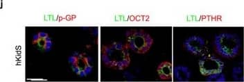 Immunocytochemistry/ Immunofluorescence: PTH1R/PTHR1 Antibody (4D2) - BSA Free [NBP1-51640] - Generation of functional kidney spheroids using immortalized human primary cells. (a) Quantitative RT-PCR analysis of kidney-specific segment markers in hKidS compared with 2D controls (2D CTL) & human kidney lysates (hKidney). n = 8 for 2D CTL & hKidS & n = 3 for hKidney. (b) Western blotting analysis for renal multi-lineage marker in mouse kidney spheroids compared to 2D CTL & hKidney. The grouping of gels/blots cropped from different parts of the same gel. (c) Representative images for cell polarity of Zo-1, an apical membrane, & Na/K ATPase, a basolateral membrane marker in hKidS. Scale bar, 10 μm. (d) Representative images of human kidney spheroids (hKidS) at day 5 of maturation stained for the kidney-specific markers LTL, PNA, AQP2, & Nephrin. Human kidney was used as positive control for immunostaining of hKidS. (e) Responses to parathyroid hormone (PTH) of hKidS compared with 3D control spheroids (without maturation factors, CTL) & 2D cells. (f) GGT activity in hKidS compared with 3D CTL. (g) Temperature-dependent albumin-fluorescein uptake of hKidS compared to 3D CTL. n = 10 for 3D CTL & hKidS. (h,i) Relative mRNA expression of apical (h) & basolateral (i) transporters in hKidS compared to 2D cultured cells, hPTECs spheroids generated using the same protocol for hKidS (hPTECs-3D), & hKidney. n = 9 for 2D CTL & hKidS & n = 3 for hPTECs-3D & hKidney. (j) Representative images of hKidS immunostained for p-GP, OCT2, & PTHR. All data are shown as the means ± s.e.m. *p < 0.05 compared with 2D or 3D control by unpaired Student’s t-test. Scale bar, 20 μm. Image collected & cropped by CiteAb from the following publication (//pubmed.ncbi.nlm.nih.gov/31772214), licensed under a CC-BY license. Not internally tested by Novus Biologicals.