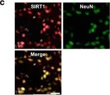 Immunocytochemistry/ Immunofluorescence: Sirtuin 1/SIRT1 Antibody (1F3) - BSA Free [NBP1-51641] - Early social isolation (ESI) induces long-term changes in sirtuin1 (SIRT) mRNA expression in the mouse brain & blood & reduces the SIRT1 protein level in different brain regions. (a) The mRNA expression levels (relative expression levels=fold changes over control, normalized to PGK1 & TBP (Tata Binding Protein) genes) of SIRT1 & SIRT6 were significantly decreased in the brain of ESI compared with control mice. (b) In peripheral blood mononuclear cells (PBMCs) of ESI-treated mice, the expression level of SIRT1 mRNA was downregulated. ESI, n=9 (male (M)=6, female (F)=3); Control, n=7 (M=4, F=3) ***P<0.001; *P<0.05. (c) Confocal images showing SIRT1 (red) & NeuN (green) immunostaining plus 4,6-diamidino-2-phenylindole (DAPI) counterstaining (gray) in the brain of control mice. SIRT1 (red) colocalizes both with the neuronal marker NeuN (green) & with DAPI (gray). (d) Confocal images from the hippocampus & basolateral amygdala of control & ESI mice reacted with SIRT1 antibody. (e) Densitometric analysis of SIRT1 immunoreactivity in the motor cortex, striatum, hippocampus & basolateral amygdala revealed a significant reduction of SIRT1 immunoreactivity in ESI compared with control mice. The F/A ratio defines the mean fluorescence of individual samples (F) normalized to total surface (A). ESI, n=5; Control, n=5. ***P<0.001. Scale bars: (d) 100 μm; 25 μm. Image collected & cropped by CiteAb from the following publication (//www.nature.com/articles/tp2015125), licensed under a CC-BY license. Not internally tested by Novus Biologicals.