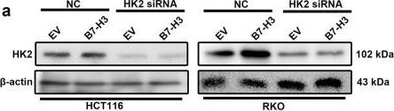 Western Blot: Hexokinase 2 Antibody (3D3) - BSA Free [NBP1-51643] - B7-H3 regulated glycolysis through HK2.a The protein level of HK2 in B7-H3-overexpressing HCT116 or RKO cells after transfection with siRNA negative control (NC) or HK2 siRNA transfection were analyzed by western blot.  beta -actin served as a loading control. b, c Glucose consumption (b) & lactate production (c) were measured in B7-H3-overexpressing HCT116 or RKO cells transfected with NC or HK2 siRNA. d, e Glucose consumption (d) & lactate production (e) were measured in B7-H3-overexpressing HCT116 or RKO cells treated with PBS or 2-DG. Values are expressed as means (SEMs). Five samples were analyzed per condition, & the experiments were performed in triplicate. *P < 0.05 Image collected & cropped by CiteAb from the following publication (//pubmed.ncbi.nlm.nih.gov/30952834), licensed under a CC-BY license. Not internally tested by Novus Biologicals.