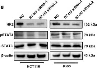 Western Blot: Hexokinase 2 Antibody (3D3) - BSA Free [NBP1-51643] - B7-H3 promoted the expression of HK2 in CRC cells.a, b The expression of glycolysis-related genes was detected by RT-qPCR in both B7-H3-overexpressing HCT116 (a) & RKO (b) cells. c, d The mRNA level of HK2 was detected by RT-qPCR in both HCT116 (c) & RKO (d) cells after transfection with siRNA NC, B7-H3 siRNA-1 or B7-H3 siRNA-2. e HK2 protein level & STAT3 activation (examined by the p-STAT3 expression level) were detected by western blot in both HCT116 & RKO cells after transfection with NC, B7-H3 siRNA-1 or B7-H3 siRNA-2.  beta -actin served as a loading control. f HK2 protein level & STAT3 activation (examined by the p-STAT3 expression level) were detected by western blot in both B7-H3-overexpressing HCT116 & RKO cells.  beta -actin served as a loading control. g Schematic representation of the proposed B7-H3/STAT3/HK2 axis. Values are expressed as means (SEMs). Five samples were analyzed per condition, & the experiments were performed in triplicate. *P < 0.05 Image collected & cropped by CiteAb from the following publication (//pubmed.ncbi.nlm.nih.gov/30952834), licensed under a CC-BY license. Not internally tested by Novus Biologicals.