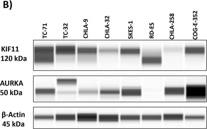 An in silico bioinformatics screen identifies mitotic proteins essential for EWS growth. (A) The DepMap portal was used to access the RNA expression data across different cancer cell lines. Expression in Ewing sarcoma is highlighted in red. Capillary-based analysis of protein lysates from EWS cell lines indicating expression of (B) KIF11 and AURKA and (C) KIF15 and TPX2 protein levels. The uncropped blots are shown in Figure S3. Image collected and cropped by CiteAb from the following open publication (//pubmed.ncbi.nlm.nih.gov/37894278), licensed under a CC-BY license. Not internally tested by Novus Biologicals.