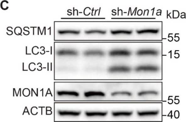 (A-B) N2S cells were transfected with Mon1a shRNA or nontargeting shRNA. The level GTP-RAB7 were detected by GST-R7BD affinity-isolation assay. Data are quantified as mean +/- SEM (n = 3). *P < 0.05, **P < 0.01, ***P < 0.001 vs. the relative control. (C-F) Cells were transfected with Mon1a shRNA, and the levels of SQSTM1 and LC3-II were examined by immunoblotting. *P < 0.05, **P < 0.01, ***P < 0.001 vs. the relative control. (G-I) Autophagosome maturation in N2a cells transfected with Mon1a shRNA or nontargeting shRNA were determined by the GFP-RFG-LC3 probe. Quantification data are presented as the mean +/- SEM, n = 20-25 cells from 3 independent experiments. *P < 0.05, **P < 0.01, vs. the relative control. Scale bar: 5 μm. (J-K) SQSTM1 levels were determined by immunofluorescence in control and Mon1a KD cells. Quantification data are presented as the mean +/- SEM, n = 20-25 cells from 3 independent experiments. *P < 0.05, **P < 0.01, vs. the relative control. Scale bar: 5 μm. Image collected and cropped by CiteAb from the following open publication (//pubmed.ncbi.nlm.nih.gov/35198070), licensed under a CC-BY license. Not internally tested by Novus Biologicals.