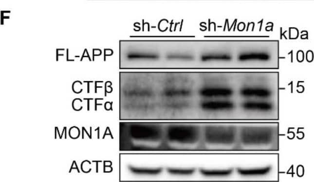 (A-C) After the N2S cells were transfected with Flag-CCZ1/Flag-MON1A or Flag vehicle, the levels of FL-APP, APP-CTFs and Flag-CCZ1, Flag-MON1A were examined by immunoblotting. Data are quantified as mean +/- SEM (n = 3). *P < 0.05, **P < 0.01, vs. the relative control. (D-E) Intracellular and extracellular A beta 1-40 and A beta 1-42 levels in N2S cells over-expressing CCZ1-MON1A were determined by ELISA analysis. Data are quantified as mean +/- SEM (n = 3). *P < 0.05, **P < 0.01, ***P < 0.001 vs. the relative control. (F-H) N2S cells were transfected with Mon1a shRNA or nontargeting shRNA. The levels of FL-APP, APP-CTFs were detected by immunoblotting. Data are quantified as mean +/- SEM (n = 3). *P < 0.05, **P < 0.01, ***P < 0.001 vs. the relative control. (I-J) ELISA analysis of intracellular and extracellular A beta  levels in control and Mon1a KD cells. Data are quantified as mean +/- SEM (n = 3). *P < 0.05, **P < 0.01, ***P < 0.001 vs. the relative control. (K-L) N2S cells over-expressing CCZ1-MON1A were transiently transfected with GFP-Lc3 and stained with APP antibody. The colocalization of GFP-LC3 and APP/APP-CTFs was visualized under confocal microscope. Quantification data are presented as the mean +/- SEM, n = 20-25 cells from 3 independent experiments. Scale bar, 7.5 μm. (M-N) N2S cells over-expressing CCZ1-MON1A were transiently transfected with mcherry-LAMP1 and the GFP-APP, and the colocalization of mcherry-LAMP1 and GFP-APP under basal or CQ treated conditions were visualized under confocal microscope. Quantification data were presented as the mean +/- SEM, n = 20-25 cells from 3 independent experiments. Scale bar, 7.5 μm. Image collected and cropped by CiteAb from the following open publication (//pubmed.ncbi.nlm.nih.gov/35198070), licensed under a CC-BY license. Not internally tested by Novus Biologicals.