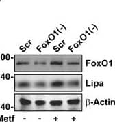 Western Blot: Lipase A Antibody - BSA Free [NBP1-54155] - FoxO1-mediated lysosomal acid lipase (Lipa) induction in NR & Metf-treated 3T3-L1 adipocytes. (a) WB of FoxO1, ATGL & Lipa in total protein extracts from 3T3-L1 adipocytes at different times of NR. (b) RT-qPCR analysis of relative Lipa & ATGL mRNA levels in 3T3-L1 after 4 h from NR. Dashed line indicates mRNA value of controls. (c) After 4 h from NR, 3T3-L1 adipocytes refed w/ complete cell culture medium (CM) up to 8 h. Total protein extracts used for WB analysis of FoxO1 & Lipa. (d) WB of FoxO1 in total & nuclear protein extracts from 3T3-L1 adipocytes at different times of NR. (e) ChIP assay carried out on crosslinked nuclei from 3T3-L1 adipocytes subjected to NR for 4 h & Metf for 16 h by using FoxO1 antibody followed by qPCR analysis of FoxO1RE on Lipa promoter (−51 bp). Dashed line indicates IgG value. (f & g) 3T3-L1 adipocytes transfected w/ siRNA against FoxO1 (FoxO1(−)) or w/ a scramble siRNA (Scr). WB of FoxO1 & Lipa (f) & RT-qPCR analysis of relative Lipa mRNA level (g) performed in 3T3-L1 adipocytes 4 h after NR. (h) WB of FoxO1 & Lipa in 3T3-L1 adipocytes at different times of 5 mM Metformin (Metf) treatment. (i) Confocal analysis of FoxO1 localization in 3T3-L1 adipocytes treated w/ 5 mM Metf for 16 h. Nuclei stained w/ Hoechst 33342. Colocalization plugin (ImageJ Software) used to identify FoxO1-Hoechst colocalization (white spots). (j) RT-qPCR analysis of relative Lipa mRNA level performed in 3T3-L1 adipocytes treated w/ Metf for 16 h. (k) 3T3-L1 adipocytes transfected w/ siRNA against FoxO1 (FoxO1(−)) or w/ a scramble siRNA (Scr). WB of FoxO1 & Lipa performed in 3T3-L1 adipocytes treated w/ 5 mM Metf for 24 h. All values given as mean±S.D. (n=4). *P<0.05, **P<0.01 versus controls. °P<0.05 versus NR Image collected & cropped by CiteAb from the following publication (//pubmed.ncbi.nlm.nih.gov/24136225), licensed under a CC-BY license. Not internally tested by Novus Biologicals.