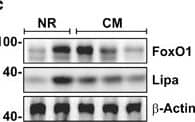 Western Blot: Lipase A Antibody - BSA Free [NBP1-54155] - FoxO1-mediated lysosomal acid lipase (Lipa) induction in NR & Metf-treated 3T3-L1 adipocytes. (a) WB of FoxO1, ATGL & Lipa in total protein extracts from 3T3-L1 adipocytes at different times of NR. (b) RT-qPCR analysis of relative Lipa & ATGL mRNA levels in 3T3-L1 after 4 h from NR. Dashed line indicates mRNA value of controls. (c) After 4 h from NR, 3T3-L1 adipocytes refed w/ complete cell culture medium (CM) up to 8 h. Total protein extracts used for WB analysis of FoxO1 & Lipa. (d) WB of FoxO1 in total & nuclear protein extracts from 3T3-L1 adipocytes at different times of NR. (e) ChIP assay carried out on crosslinked nuclei from 3T3-L1 adipocytes subjected to NR for 4 h & Metf for 16 h by using FoxO1 antibody followed by qPCR analysis of FoxO1RE on Lipa promoter (−51 bp). Dashed line indicates IgG value. (f & g) 3T3-L1 adipocytes transfected w/ siRNA against FoxO1 (FoxO1(−)) or w/ a scramble siRNA (Scr). WB of FoxO1 & Lipa (f) & RT-qPCR analysis of relative Lipa mRNA level (g) performed in 3T3-L1 adipocytes 4 h after NR. (h) WB of FoxO1 & Lipa in 3T3-L1 adipocytes at different times of 5 mM Metformin (Metf) treatment. (i) Confocal analysis of FoxO1 localization in 3T3-L1 adipocytes treated w/ 5 mM Metf for 16 h. Nuclei stained w/ Hoechst 33342. Colocalization plugin (ImageJ Software) used to identify FoxO1-Hoechst colocalization (white spots). (j) RT-qPCR analysis of relative Lipa mRNA level performed in 3T3-L1 adipocytes treated w/ Metf for 16 h. (k) 3T3-L1 adipocytes transfected w/ siRNA against FoxO1 (FoxO1(−)) or w/ a scramble siRNA (Scr). WB of FoxO1 & Lipa performed in 3T3-L1 adipocytes treated w/ 5 mM Metf for 24 h. All values given as mean±S.D. (n=4). *P<0.05, **P<0.01 versus controls. °P<0.05 versus NR Image collected & cropped by CiteAb from the following publication (//pubmed.ncbi.nlm.nih.gov/24136225), licensed under a CC-BY license. Not internally tested by Novus Biologicals.