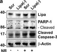 Western Blot: Lipase A Antibody - BSA Free [NBP1-54155] - Lipa downregulation impairs lipid breakdown & elicits cell death in nutrient restricted adipocytes. (a) 3T3-L1 adipocytes were transfected with siRNA against Lipa (Lipa(−)) or with a scramble siRNA (Scr). Western blot of Lipa, PARP-1 & cleaved form of caspase-3 in total protein extracts from 3T3-L1 adipocytes after 4 h of NR. (b) TG content was quantified by ORO staining in fixed 3T3-L1 adipocytes 6 h after NR. (c) RT-qPCR analysis of relative peroxisome proliferator-activated receptor gamma-1 alpha , peroxisome proliferator-activated receptor-alpha  & carnitine palmitoyltransferase 1b mRNA levels was performed in 3T3-L1 adipocytes 4 h after NR. (d) FFAs were analyzed in culture medium 6 h after NR.  beta -actin was used as loading control. All values are given as mean±S.D. *P<0.05, **P<0.01 versus controls; °P<0.05 versus NR treatment. All data are representative of at least three independent experiments Image collected & cropped by CiteAb from the following publication (//pubmed.ncbi.nlm.nih.gov/24136225), licensed under a CC-BY license. Not internally tested by Novus Biologicals.