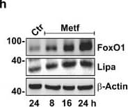 Western Blot: Lipase A Antibody - BSA Free [NBP1-54155] - FoxO1-mediated lysosomal acid lipase (Lipa) induction in NR & Metf-treated 3T3-L1 adipocytes. (a) WB of FoxO1, ATGL & Lipa in total protein extracts from 3T3-L1 adipocytes at different times of NR. (b) RT-qPCR analysis of relative Lipa & ATGL mRNA levels in 3T3-L1 after 4 h from NR. Dashed line indicates mRNA value of controls. (c) After 4 h from NR, 3T3-L1 adipocytes refed w/ complete cell culture medium (CM) up to 8 h. Total protein extracts used for WB analysis of FoxO1 & Lipa. (d) WB of FoxO1 in total & nuclear protein extracts from 3T3-L1 adipocytes at different times of NR. (e) ChIP assay carried out on crosslinked nuclei from 3T3-L1 adipocytes subjected to NR for 4 h & Metf for 16 h by using FoxO1 antibody followed by qPCR analysis of FoxO1RE on Lipa promoter (−51 bp). Dashed line indicates IgG value. (f & g) 3T3-L1 adipocytes transfected w/ siRNA against FoxO1 (FoxO1(−)) or w/ a scramble siRNA (Scr). WB of FoxO1 & Lipa (f) & RT-qPCR analysis of relative Lipa mRNA level (g) performed in 3T3-L1 adipocytes 4 h after NR. (h) WB of FoxO1 & Lipa in 3T3-L1 adipocytes at different times of 5 mM Metformin (Metf) treatment. (i) Confocal analysis of FoxO1 localization in 3T3-L1 adipocytes treated w/ 5 mM Metf for 16 h. Nuclei stained w/ Hoechst 33342. Colocalization plugin (ImageJ Software) used to identify FoxO1-Hoechst colocalization (white spots). (j) RT-qPCR analysis of relative Lipa mRNA level performed in 3T3-L1 adipocytes treated w/ Metf for 16 h. (k) 3T3-L1 adipocytes transfected w/ siRNA against FoxO1 (FoxO1(−)) or w/ a scramble siRNA (Scr). WB of FoxO1 & Lipa performed in 3T3-L1 adipocytes treated w/ 5 mM Metf for 24 h. All values given as mean±S.D. (n=4). *P<0.05, **P<0.01 versus controls. °P<0.05 versus NR Image collected & cropped by CiteAb from the following publication (//pubmed.ncbi.nlm.nih.gov/24136225), licensed under a CC-BY license. Not internally tested by Novus Biologicals.