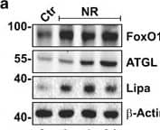 Western Blot: Lipase A Antibody - BSA Free [NBP1-54155] - FoxO1-mediated lysosomal acid lipase (Lipa) induction in NR & Metf-treated 3T3-L1 adipocytes. (a) WB of FoxO1, ATGL & Lipa in total protein extracts from 3T3-L1 adipocytes at different times of NR. (b) RT-qPCR analysis of relative Lipa & ATGL mRNA levels in 3T3-L1 after 4 h from NR. Dashed line indicates mRNA value of controls. (c) After 4 h from NR, 3T3-L1 adipocytes refed w/ complete cell culture medium (CM) up to 8 h. Total protein extracts used for WB analysis of FoxO1 & Lipa. (d) WB of FoxO1 in total & nuclear protein extracts from 3T3-L1 adipocytes at different times of NR. (e) ChIP assay carried out on crosslinked nuclei from 3T3-L1 adipocytes subjected to NR for 4 h & Metf for 16 h by using FoxO1 antibody followed by qPCR analysis of FoxO1RE on Lipa promoter (−51 bp). Dashed line indicates IgG value. (f & g) 3T3-L1 adipocytes transfected w/ siRNA against FoxO1 (FoxO1(−)) or w/ a scramble siRNA (Scr). WB of FoxO1 & Lipa (f) & RT-qPCR analysis of relative Lipa mRNA level (g) performed in 3T3-L1 adipocytes 4 h after NR. (h) WB of FoxO1 & Lipa in 3T3-L1 adipocytes at different times of 5 mM Metformin (Metf) treatment. (i) Confocal analysis of FoxO1 localization in 3T3-L1 adipocytes treated w/ 5 mM Metf for 16 h. Nuclei stained w/ Hoechst 33342. Colocalization plugin (ImageJ Software) used to identify FoxO1-Hoechst colocalization (white spots). (j) RT-qPCR analysis of relative Lipa mRNA level performed in 3T3-L1 adipocytes treated w/ Metf for 16 h. (k) 3T3-L1 adipocytes transfected w/ siRNA against FoxO1 (FoxO1(−)) or w/ a scramble siRNA (Scr). WB of FoxO1 & Lipa performed in 3T3-L1 adipocytes treated w/ 5 mM Metf for 24 h. All values given as mean±S.D. (n=4). *P<0.05, **P<0.01 versus controls. °P<0.05 versus NR Image collected & cropped by CiteAb from the following publication (//pubmed.ncbi.nlm.nih.gov/24136225), licensed under a CC-BY license. Not internally tested by Novus Biologicals.