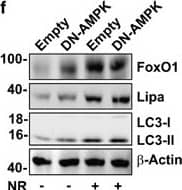 Western Blot: Lipase A Antibody - BSA Free [NBP1-54155] - AMPK drives Lipa-released FFAs oxidation restraining energetic catastrophe. (a) 3T3-L1 cells were transfected with DN-AMPK or empty vector. RT-qPCR analysis of relative peroxisome proliferator-activated receptor gamma-1 alpha , peroxisome proliferator-activated receptor-alpha , carnitine palmitoyltransferase 1b & acyl-CoA oxidase 1 mRNA levels were performed after 4 h of NR or 16 h of Metf treatment. Dashed line indicates the mRNA value of untreated DN-AMPK cells (Ctr). mRNA levels of untreated cells transfected with empty vector were similar to untreated DN-AMPK cells (data not shown). (b) Cheminoluminescent assay of ATP level in 3T3-L1 adipocytes transfected with DN-AMPK or empty vector after 8 h NR or 16 h Metf treatment. ATP level was expressed as pmol ATP per mg protein. (c) After 8 h of NR or 16 h Metf treatment, FFAs were enzymatically detected in culture medium of 3T3-L1 adipocytes transfected with DN-AMPK or empty vector. Values were expressed as μg FFAs per mg protein. (d) Left panel: western blot of AMPKpT172, PARP-1 & cleaved form of caspase-3 in 3T3-L1 adipocytes transfected with DN-AMPK or empty vector & subjected to 8 h NR. Right panel: cytofluorimetric analysis of apoptosis in DN-AMPK cells subjected to 8 h NR. (e) Western blot of PARP-1 & cleaved form of caspase-3 in 3T3-L1 adipocytes transfected with DN-AMPK or empty vector & treated with Metf for 16 h. (f) Western blot of FoxO1, Lipa, LC3 in 3T3-L1 adipocytes transfected with DN-AMPK or empty vector & subjected to 4 h NR.  beta -actin was used as loading control. All values are given as mean±S.D. *P<0.05, **P<0.01 versus controls; °P<0.05, °°P<0.01 versus Metf treatment. All data are representative of at least three independent experiments Image collected & cropped by CiteAb from the following publication (//pubmed.ncbi.nlm.nih.gov/24136225), licensed under a CC-BY license. Not internally tested by Novus Biologicals.