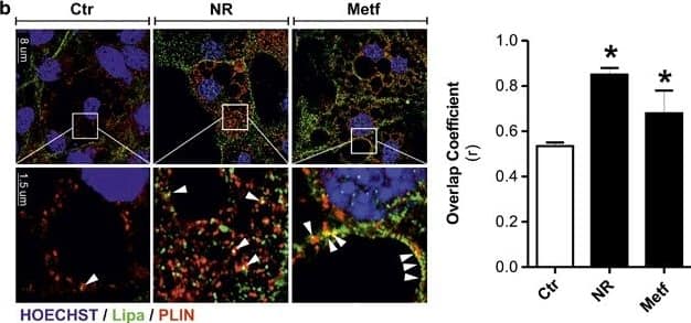 Metabolic stress triggers lipophagy in adipocytes. (a) 3T3-L1 adipocytes were transfected with EGFP-LC3 expression vector (green) and subjected to NR or treated with Metf. Cells were immunostained with PLIN antibody (red). (b) 3T3-L1 adipocytes were subjected to NR or treated with Metf for 8 h. Cells were immunostained with Lipa (green) and PLIN (red) antibodies. (c) 3T3-L1 adipocytes were subjected to NR or treated with Metf for 8 h. Cells were immunostained with LAMP1 antibody (green). LDs were visualized by using Nile Red (red). Nuclei were counterstained with Hoechst 33342 (blue). Arrowheads indicate examples of colocalization points. Overlap coefficients were calculated by JACoP (plugin of ImageJ Software) in at least four different images. All values are given as mean+/-S.D. *P<0.05, **P<0.01 versus controls Image collected and cropped by CiteAb from the following open publication (//pubmed.ncbi.nlm.nih.gov/24136225), licensed under a CC-BY license. Not internally tested by Novus Biologicals.