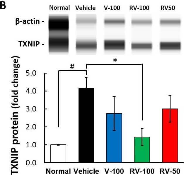 Proinflammatory cytokine (IL-6) and TXNIP expression and TUNEL assay for STZ-induced mice treated with Verapamil (V) and R-Vera (RV).(A) STZ-induced mice administered 100 mg/kg/day racemic or R-Vera exhibited significantly reduced serum IL-6 expression compared to vehicle mice whereas those administered 50 mg/kg/day R-Vera did not. **P < 0.01 indicates significant difference from vehicle using one-way ANOVA. N = 8 in each group. (B) STZ-induced mice showed highly upregulated islet tissue TXNIP compared to normal C57BL/6J mice. TXNIP was downregulated after racemic or R-Vera administration compared to vehicle. #P < 0.05 indicated significant difference between normal and vehicle; *P < 0.05 indicated significant difference to vehicle using one-way ANOVA. N = 8 in each group. (C)  beta -cell apoptosis assessed using TUNEL staining. Deep staining spots in images are apoptotic  beta -cells (200×). (D) TUNEL-positive cell counts show that STZ-induced mice administered 100 mg/kg/day R-Vera had significantly reduce  beta -cell apoptosis. *P < 0.05 indicated a significant difference between vehicle and RV-100 using one-way ANOVA. The sample numbers of 5, 7, 5, and 9 indicate the section numbers from the Vehicle, V-100, RV-100, and RV-50 groups, respectively (rather than the number of mice). Each data point represents the percentage of TUNEL–positive cells per slide in each group. Image collected and cropped by CiteAb from the following open publication (//pubmed.ncbi.nlm.nih.gov/34358247), licensed under a CC-BY license. Not internally tested by Novus Biologicals.