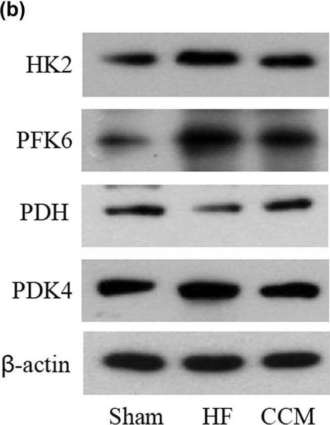 CCM treatment regulates the key glucose metabolism factors in rabbits with HF. (a) Western blot analysis of the expression of GLUT4. Densitometric analysis is shown in the bar graph. (b) Western blot analysis of the expressions of HK2, PFK6, PDH, and PDK4. Densitometric analysis is shown in the bar graph. Data are expressed as mean values +/- SD (*P < 0.05 compared with the sham group; #P < 0.05 compared with HF group). Image collected and cropped by CiteAb from the following open publication (//pubmed.ncbi.nlm.nih.gov/35799598), licensed under a CC-BY license. Not internally tested by Novus Biologicals.
